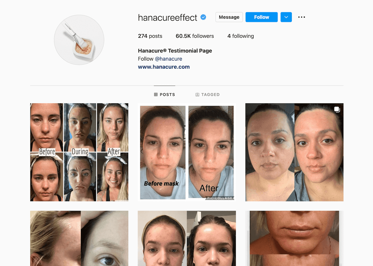 Social proof example on Instagram: Hanacure testimonial page
